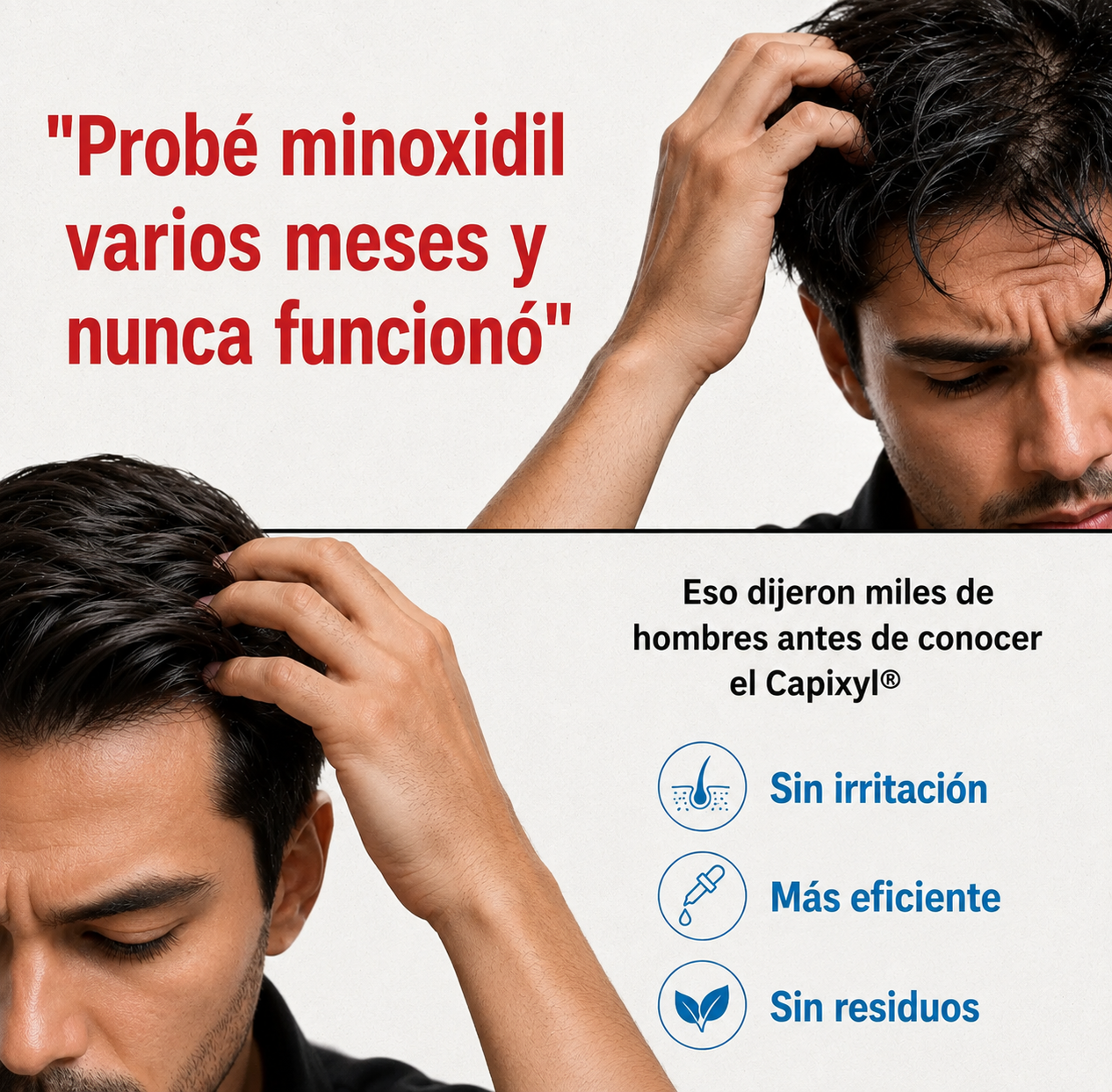 [Compra 1 y llévate 3] - cabello y barba más fuertes, densos y cuidados