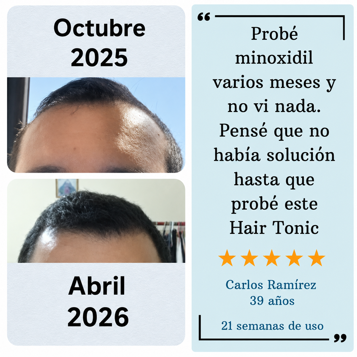 [Compra 1 y llévate 3] - cabello y barba más fuertes, densos y cuidados