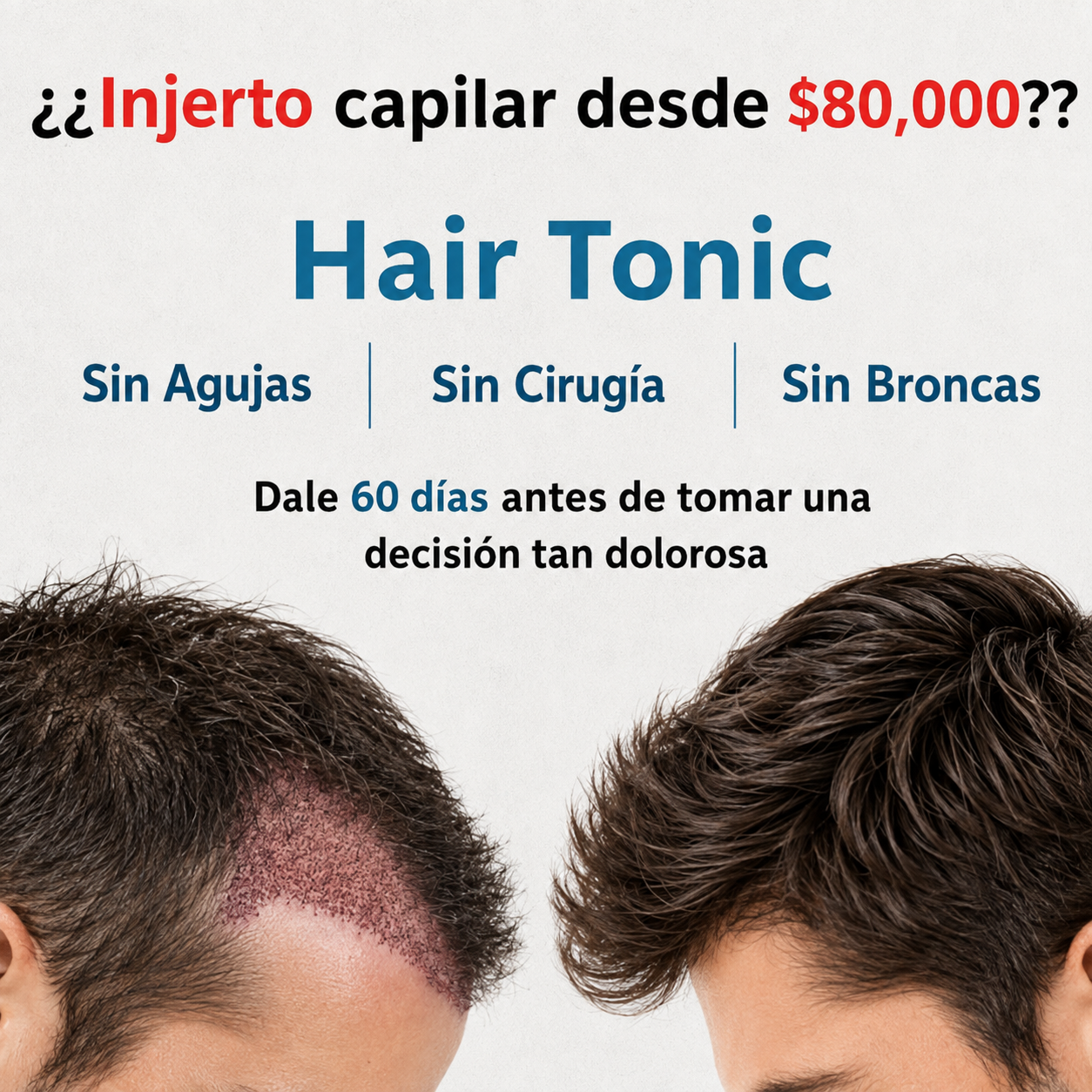 [Compra 1 y llévate 3] - cabello y barba más fuertes, densos y cuidados